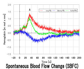 fNIRS. Red: OxyHb. Blue: DeoxyHb. Green: TotalHb.