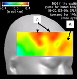 Brain Blood Flow, fNIRS, Clairvoyance, Russian Psychic