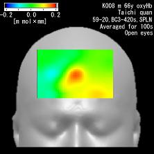 Brain blood flow (fNIRS) increased during Taichi-quan.